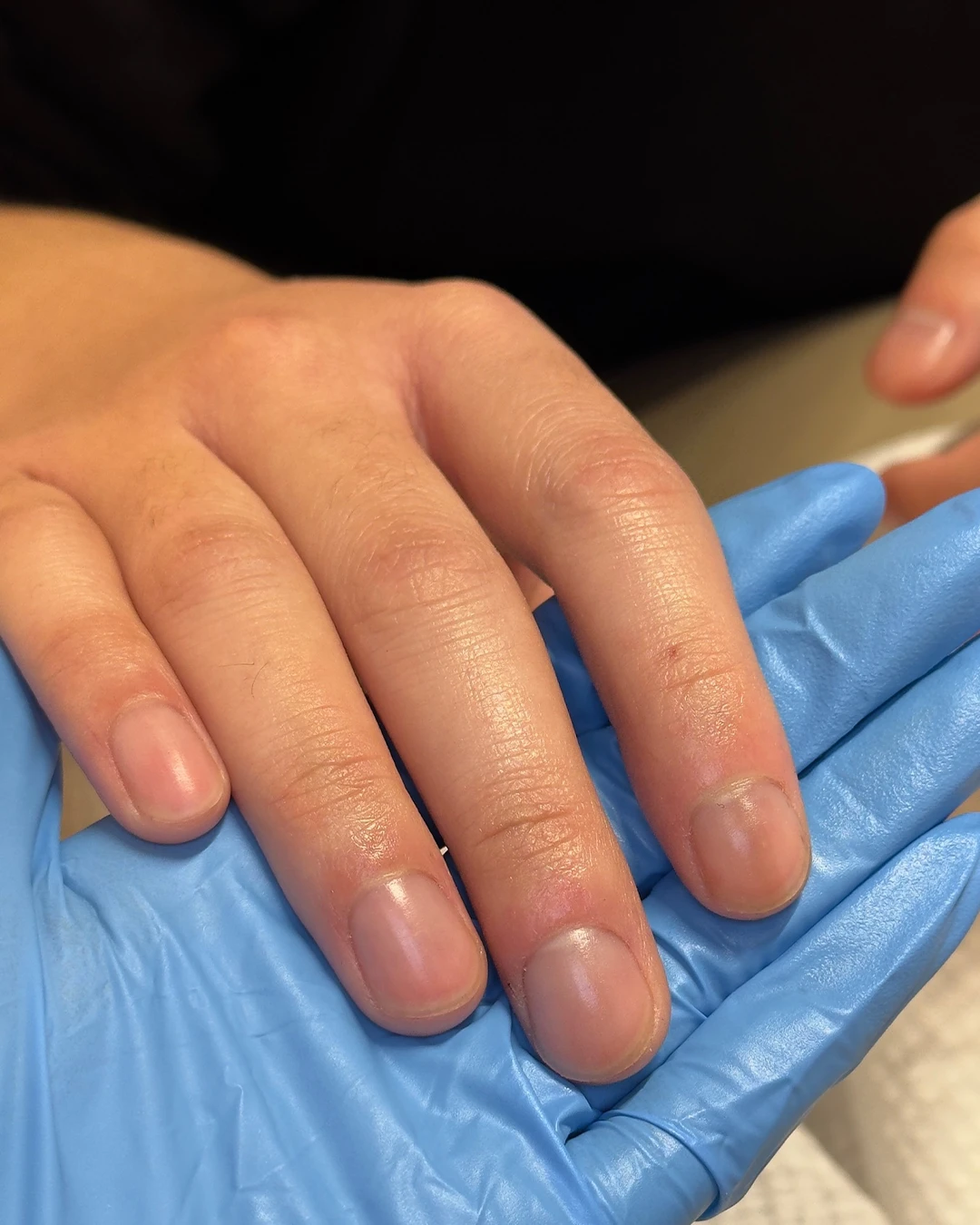 Nail Treatments