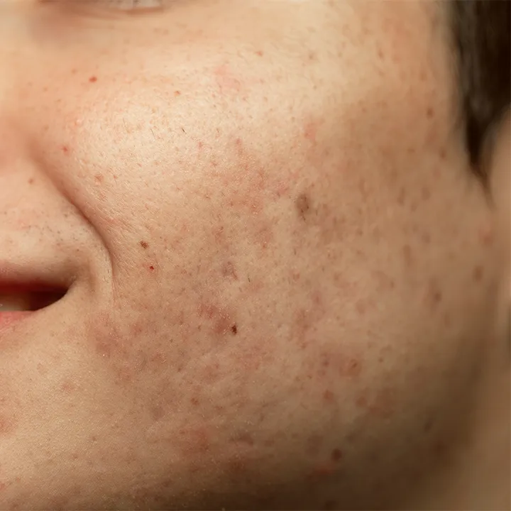 congested skin1